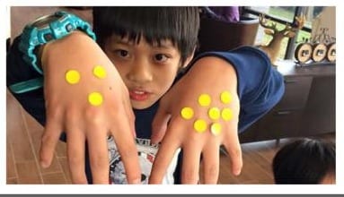 小男孩伸出雙手,手背上貼滿黃色圓點貼紙